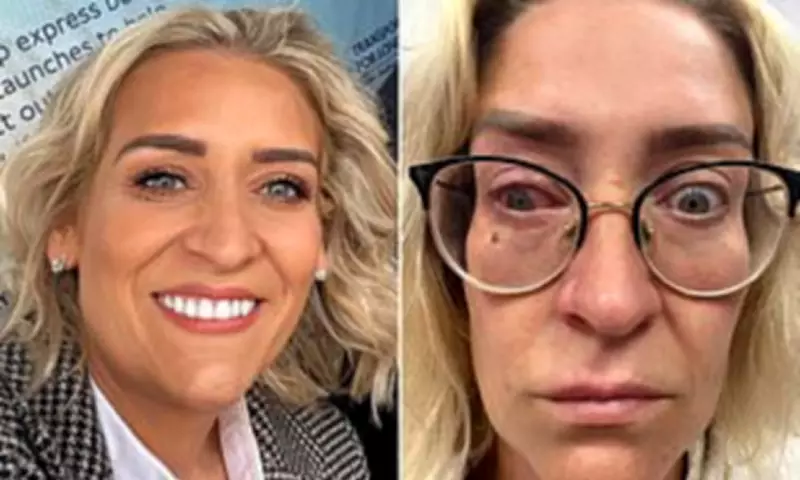 Nurse's Contact Lens Warning After Bacteria Leaves Her Blind in One Eye