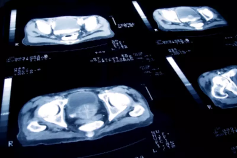 Prostate Cancer Screening Explained: What Happens During the Process