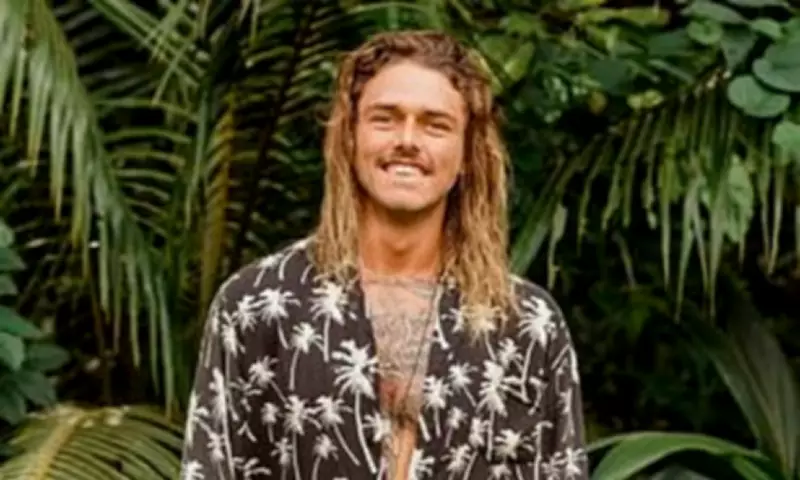 Reality Star Timm Hanly's Dramatic Transformation After Nose Surgery