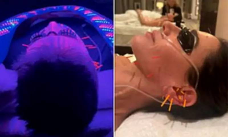 Simon Cowell's Extreme £545 Anti-Ageing Treatment with Face Needles