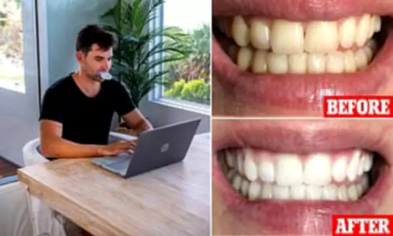 SmilePro Teeth Whitening Kit: Dentist-Developed Solution Gains Popularity in Australia