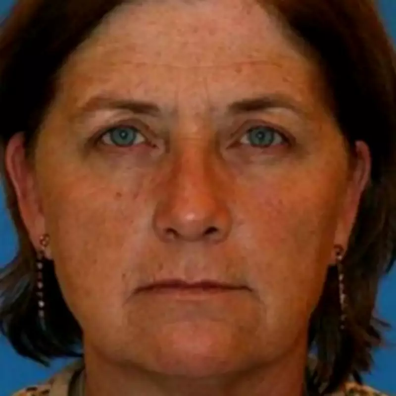 Smoking's Visible Toll: Twin Study Reveals Dramatic Ageing Differences