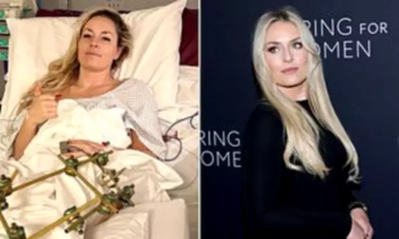 Surgeon Reveals Lindsey Vonn's Near Limb Loss After Olympic Crash