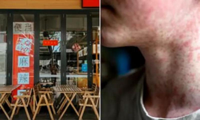 Sydney Measles Outbreak Fears Grow as Unexplained Case Emerges