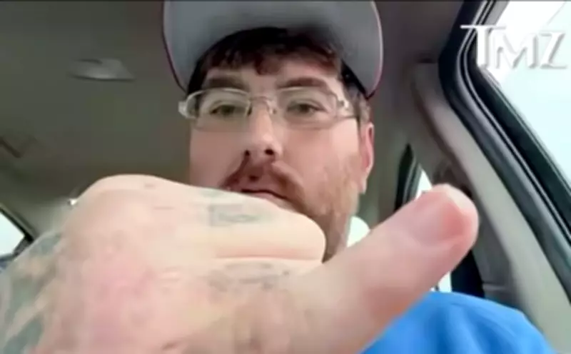 US Man Challenges World to Disprove His Claim of World's Smallest Penis