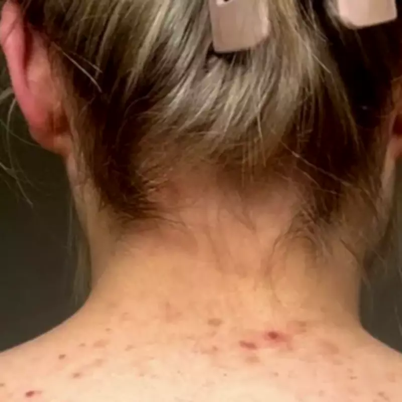 Woman Regains Confidence After Years of Hiding Body Blemishes with Skincare Routine