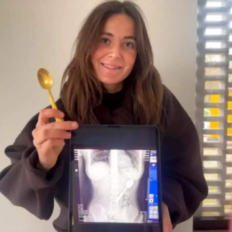 Woman Swallows 17cm Spoon During Yoghurt Mishap with Dog