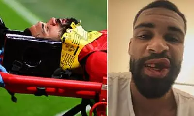 AC Milan's Ruben Loftus-Cheek Breaks Jaw and Teeth in Gruesome Injury