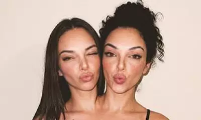 AI-Generated Conjoined Twin Influencers Exposed After Social Media Storm