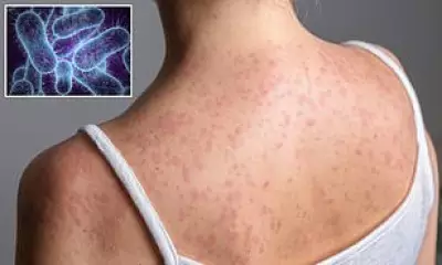 Ancient Typhoid Fever Mutates, Threatening Global Health with Drug Resistance