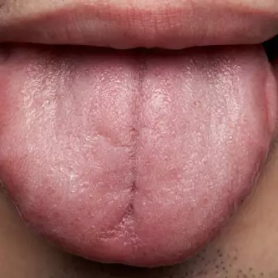 GP Warns of Overlooked Vitamin B12 Deficiency Symptoms Like Sore Tongue