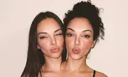 AI-Generated Conjoined Twin Influencers Exposed After Social Media Storm