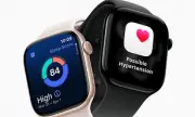 Apple Watch NHS Rollout Urged for Heart Patients After Landmark Study
