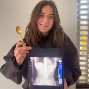 Belgian Woman Hospitalised After Swallowing 17cm Spoon During Dog Disturbance