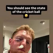 Ben Stokes Hospitalised After Cricket Ball Strikes Face During Coaching Session