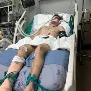 British Man in Thailand Faces Mounting Bills After Scooter Crash Leaves Him in Severe Pain