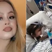 California Mother Loses All Four Limbs After Eating Undercooked Tilapia Fish