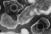 Epstein-Barr Virus: The Silent Carcinogen Linked to Multiple Sclerosis