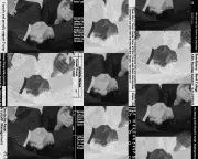 Epstein Files Expose Elite Networks and Special Rules for the Powerful