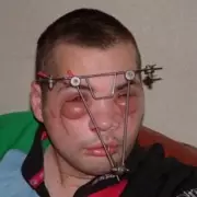 Iraq War Veteran Recalls Sniper Attack That Left Him Blind