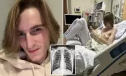 Kentucky Teen Suffers Two Lung Collapses from Vaping, Mother Issues Urgent Warning
