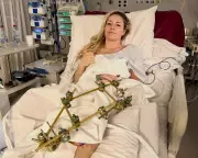 Lindsey Vonn Faces Fourth Surgery After Olympic Crash, Hopes to Return Home