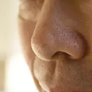 Loss of Smell Could Signal Parkinson's Disease Years Before Diagnosis