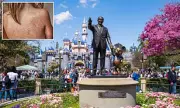 Measles Alert at Disneyland and LAX After Infected International Visitor