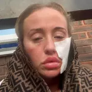 Mum's 'Suicide Disease' Leaves Her Housebound in Cold Weather