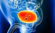 New NHS Drug Durvalumab Boosts Survival Chances for Aggressive Bladder Cancer Patients