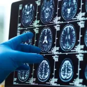 Sixteen Diseases Linked to One-Third of Global Dementia Cases in Major Study