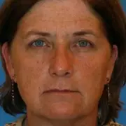 Smoking's Visible Toll: Twin Study Reveals Dramatic Ageing Differences