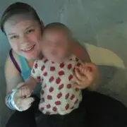 Surgeon's Amputation Warning Sparks Major Patient Recall Investigation