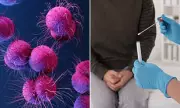Sydney Faces Urgent Health Alert Over Drug-Resistant Gonorrhoea Outbreak