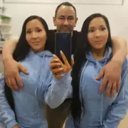 The Wild Truth Behind 'World's Most Identical Twins' Who Share Everything