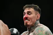 Tom Aspinall Undergoes Second Eye Surgery, Contradicting Dana White's Claims