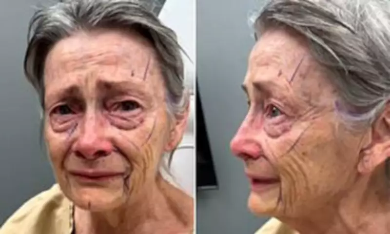 70-Year-Old's Facelift Transformation Stuns Millions on TikTok
