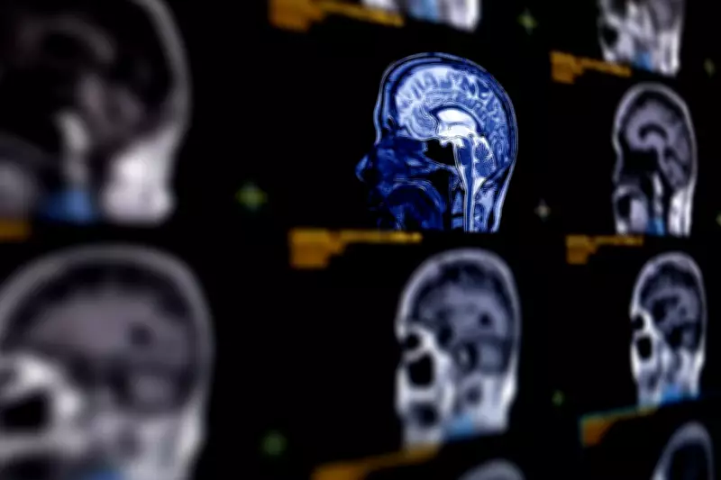 AI Achieves 93% Accuracy in Predicting Alzheimer's Disease Through Brain Scans