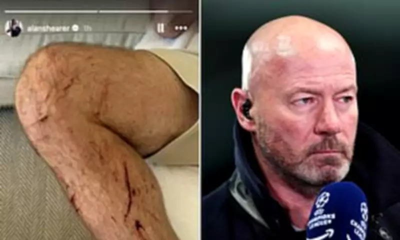 Alan Shearer Blames Potholes for Painful Cycling Accident Injuries
