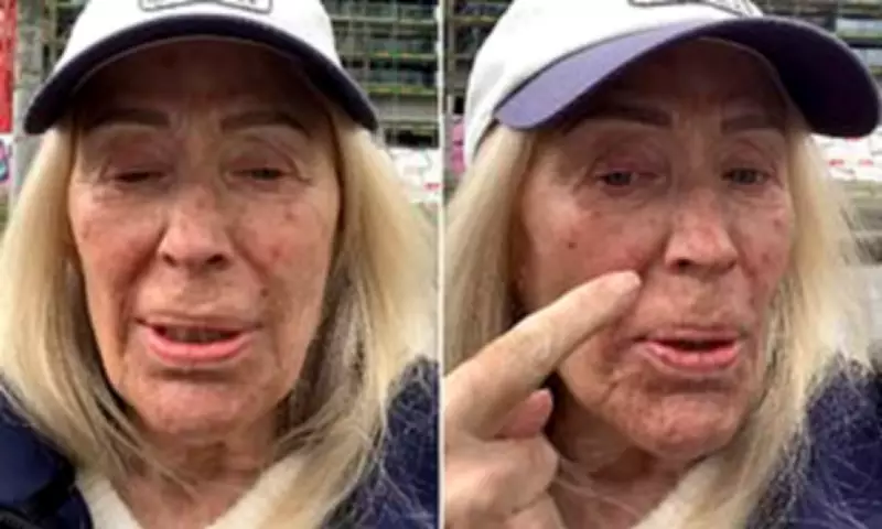 Angie Best's Cancer Battle: Acne Breakout Leaves Her Avoiding Public View