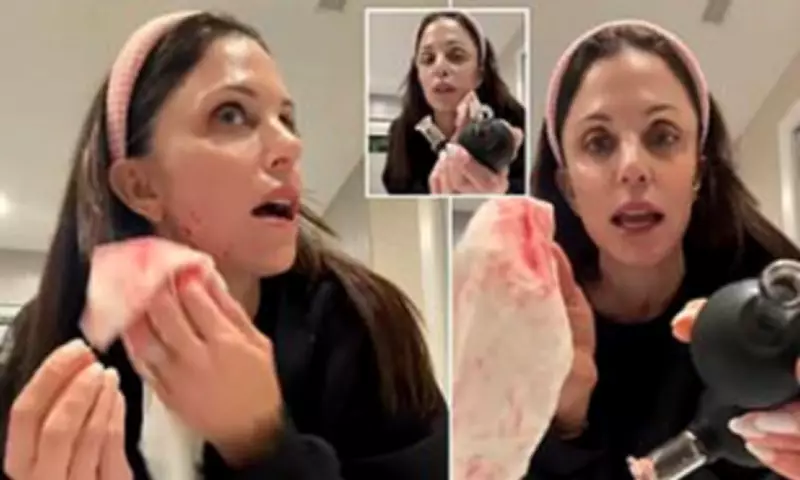 Bethenny Frankel's Beauty Gadget Nightmare Leaves Her Bleeding and Shaken
