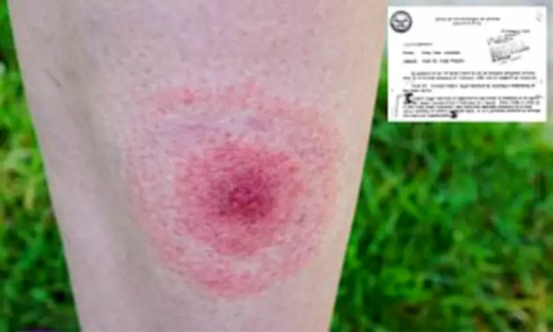 Biochemist Claims CIA Tick Experiments May Have Caused US Lyme Disease Outbreak