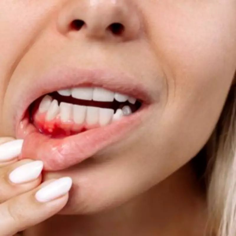 Bleeding Gums Could Signal Vitamin C Deficiency, Experts Warn