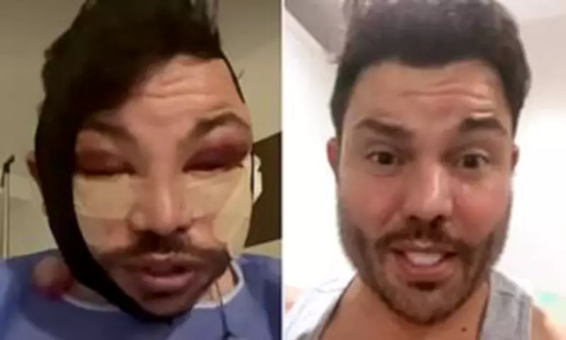 Bobby Norris Sparks Concern with Swollen Face After Cosmetic Surgery