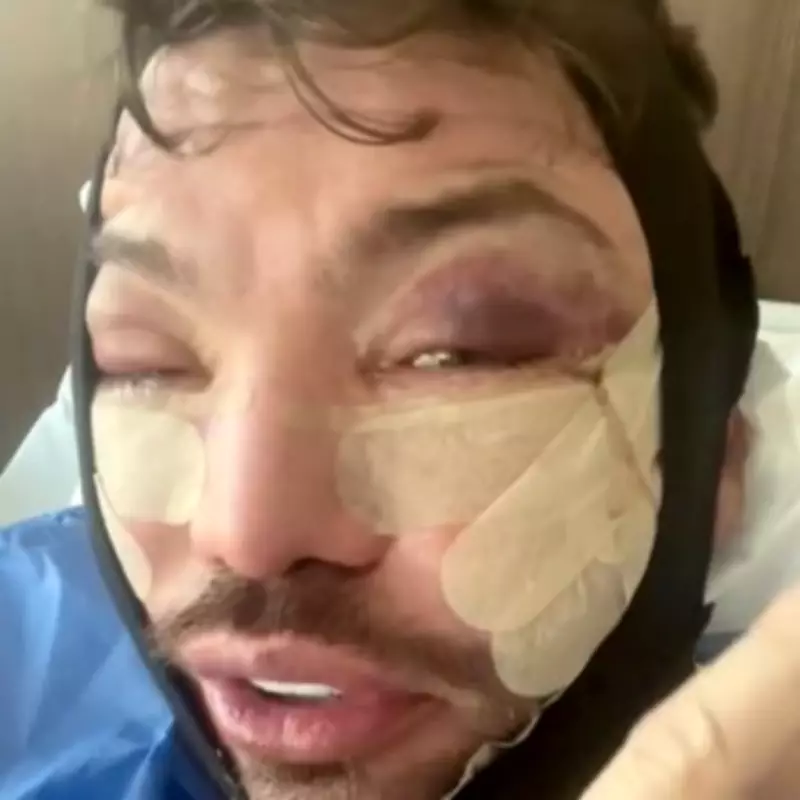 Bobby Norris Swollen and Bruised After Face and Neck Lift Surgery