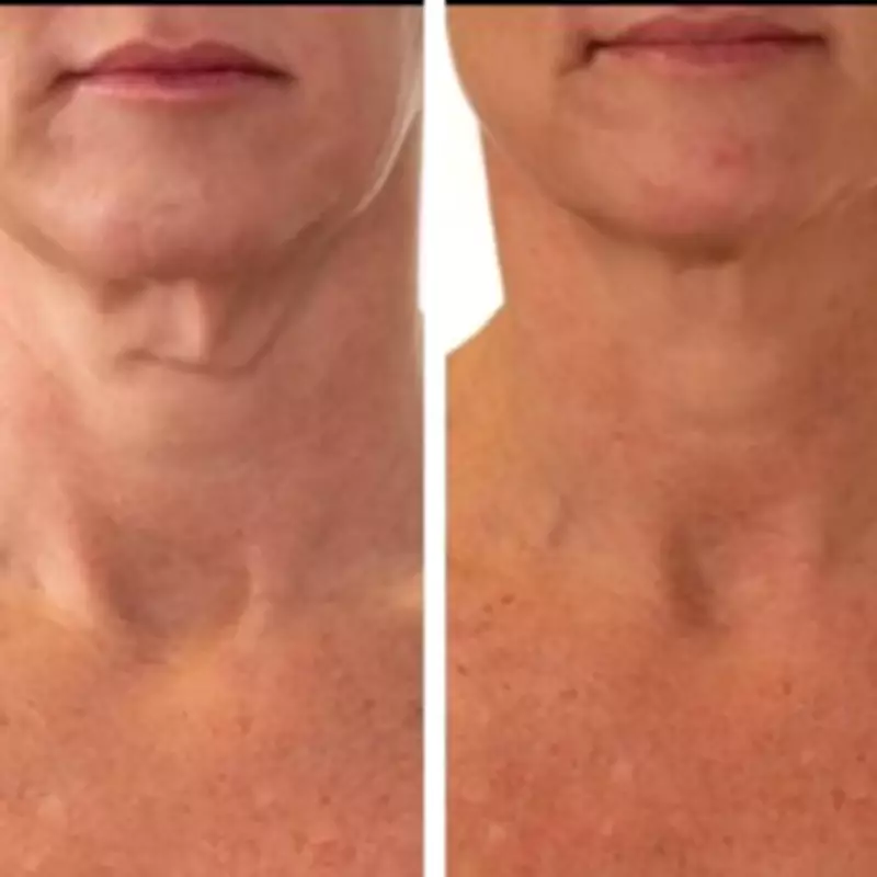 Boots Discounts PRAI Neck Cream, Mum Claims It Erased 'Turkey Neck'