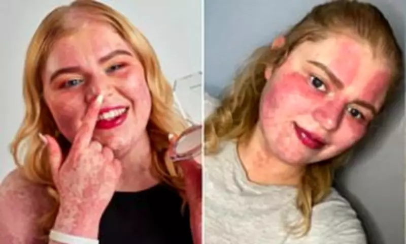 Boots Worker Asks Woman with Birthmarks If She's Dressed as Burns Victim