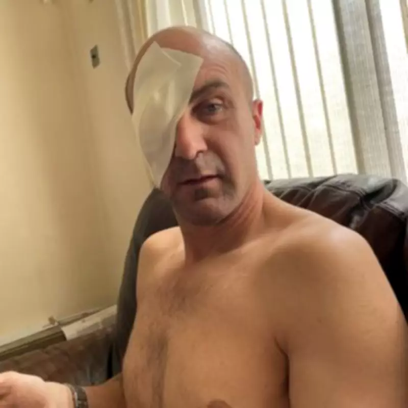 British Dad Forced to Remove Eyeball After Pool Volleyball Accident in Mexico
