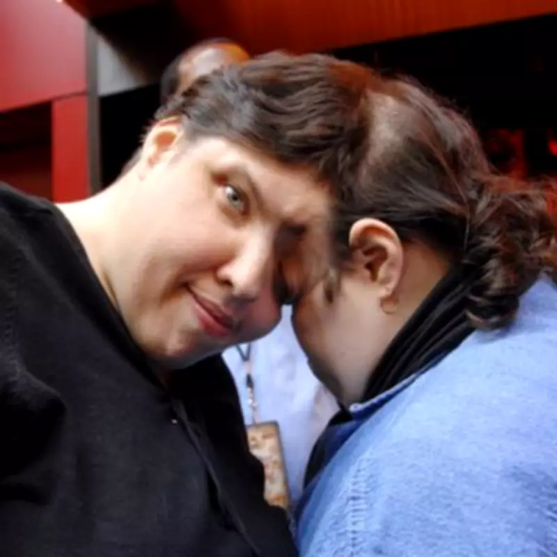 Conjoined Twin Hid Gender Transition from Sibling for Decades