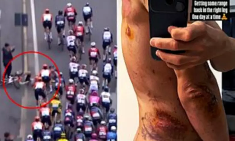 Cycling Star Michal Kwiatkowski Reveals Graphic Crash Injuries on Instagram